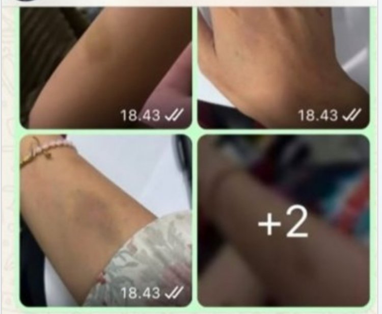 Aktivis KOMPPAK Akan Lakukan Aksi Unras,  Terkait Dugaan Okum Anggota DPRD Pandeglang Fraksi PKS Aniaya Mantan Pacar