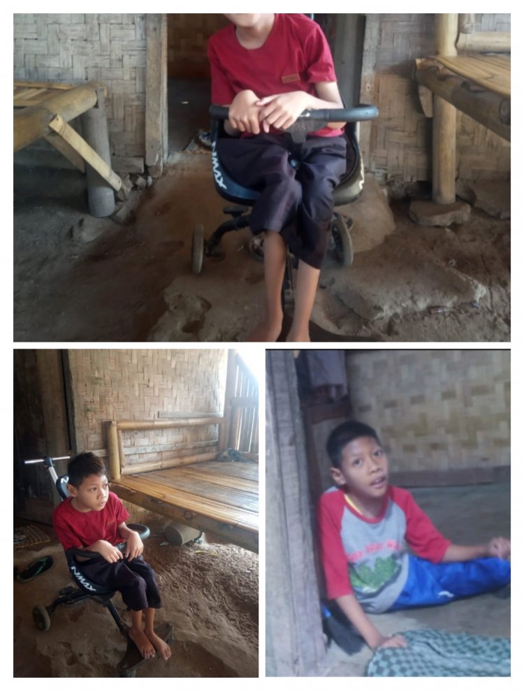Miris..!!!! Anak 10 Tahun Penderita Disabilitas Di Desa Muara, Wanasalam, Sangat Mengharapkan Bantuan